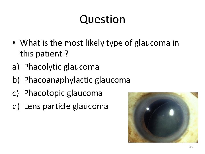 Question • What is the most likely type of glaucoma in this patient ?