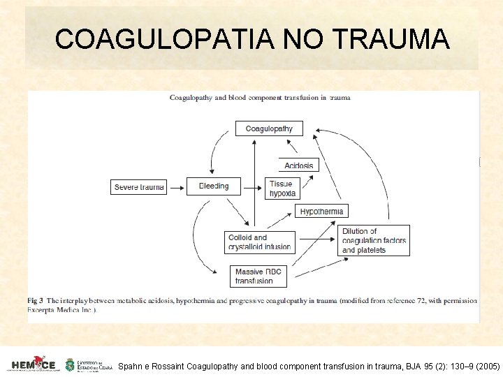 COAGULOPATIA NO TRAUMA Spahn e Rossaint Coagulopathy and blood component transfusion in trauma, BJA
