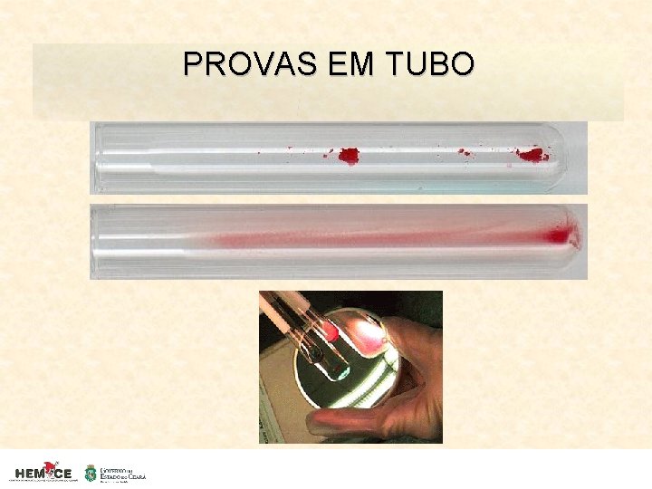 PROVAS EM TUBO 