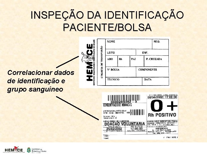 INSPEÇÃO DA IDENTIFICAÇÃO PACIENTE/BOLSA Correlacionar dados de identificação e grupo sanguíneo 