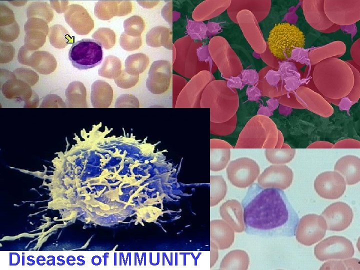 Diseases of IMMUNITY 