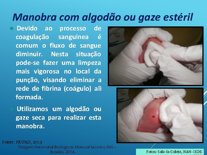 Manobra com algodão ou gaze estéril ● Devido ao processo de coagulação sanguínea é