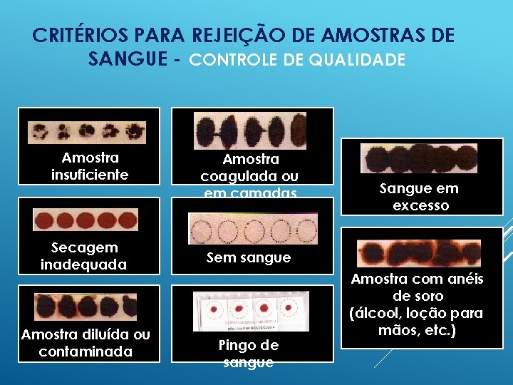 CRITÉRIOS PARA REJEIÇÃO DE AMOSTRAS DE SANGUE - CONTROLE DE QUALIDADE Amostra insuficiente Secagem