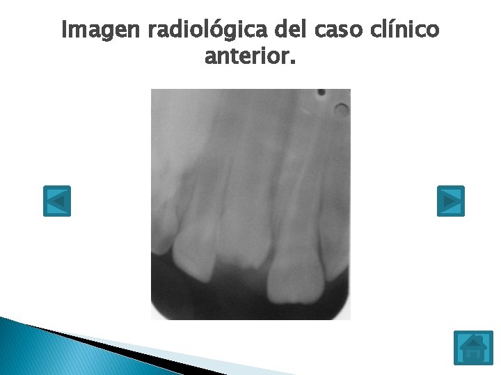 Imagen radiológica del caso clínico anterior. 