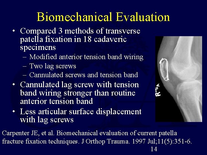 Biomechanical Evaluation • Compared 3 methods of transverse patella fixation in 18 cadaveric specimens