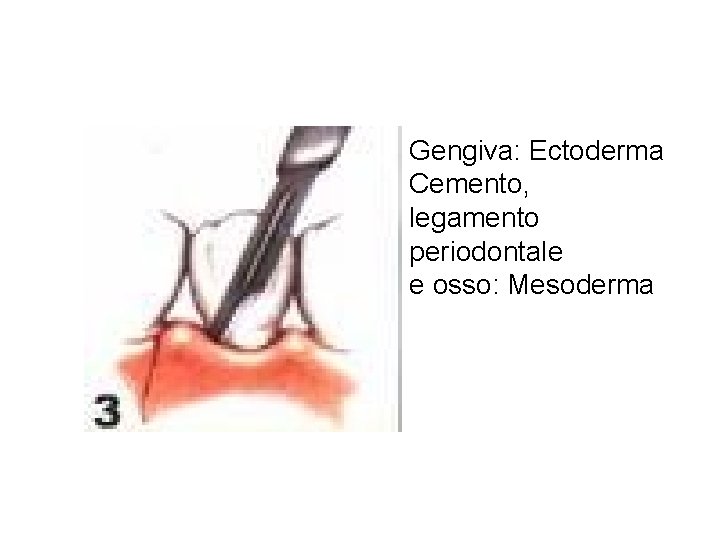 Gengiva: Ectoderma Cemento, legamento periodontale e osso: Mesoderma Gengiva: Ectoderma Cemento, legamento periodontale e osso: Mesoderma