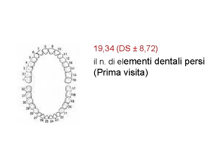 19, 34 (DS ± 8, 72) il n. di elementi dentali persi (Prima visita) 19, 34 (DS ± 8, 72) il n. di elementi dentali persi (Prima visita)