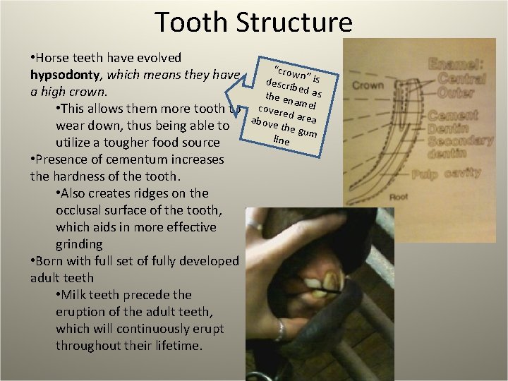 Tooth Structure • Horse teeth have evolved hypsodonty, which means they have a high