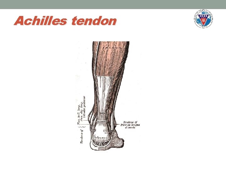 Achilles tendon 