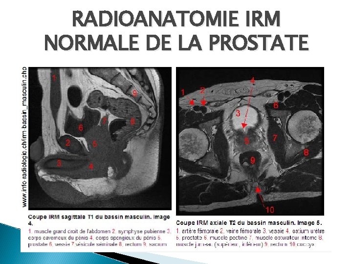 RADIOANATOMIE IRM NORMALE DE LA PROSTATE RADIOANATOMIE IRM NORMALE DE LA PROSTATE