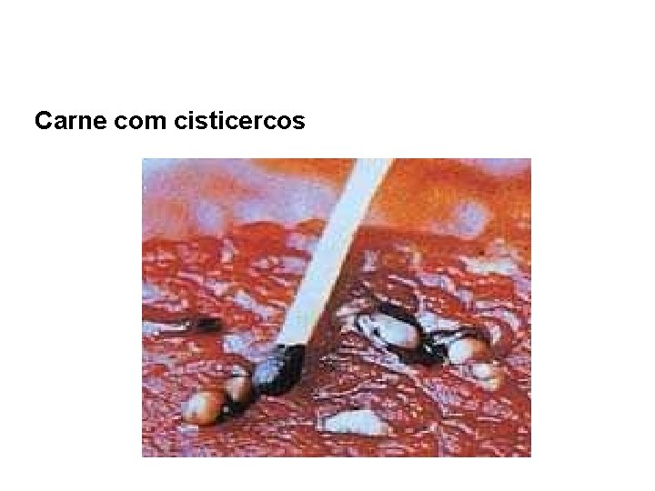 Carne com cisticercos 