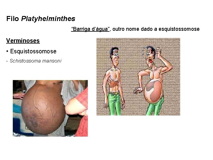 Filo Platyhelminthes “Barriga d’água”, outro nome dado a esquistossomose Verminoses • Esquistossomose - Schistossoma