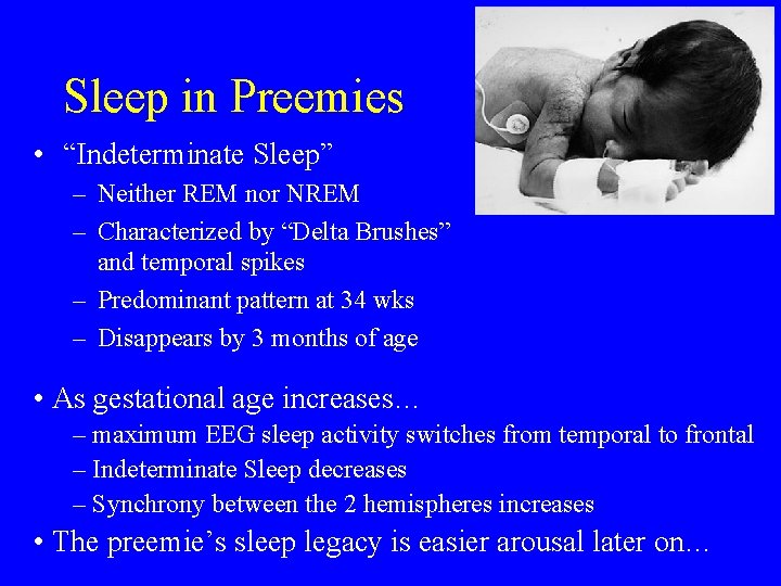 Sleep in Preemies • “Indeterminate Sleep” – Neither REM nor NREM – Characterized by