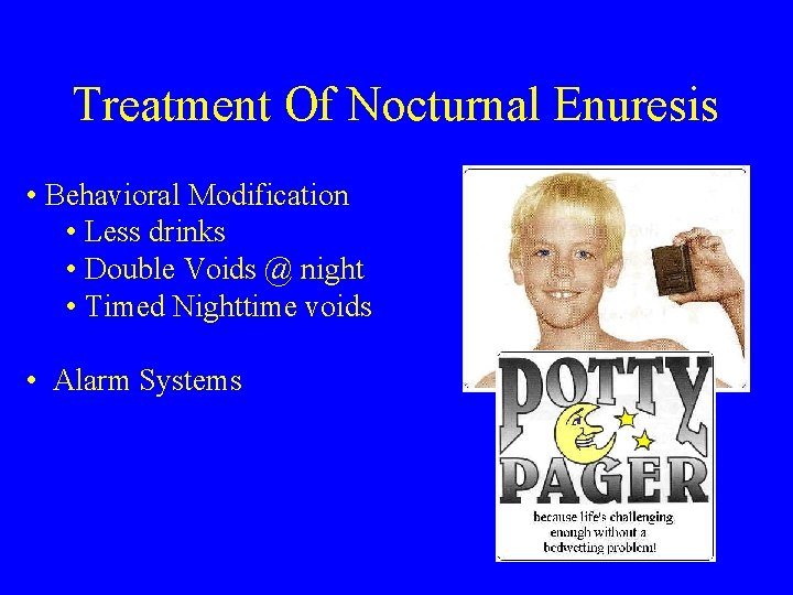 Treatment Of Nocturnal Enuresis • Behavioral Modification • Less drinks • Double Voids @