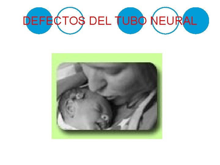 DEFECTOS DEL TUBO NEURAL 