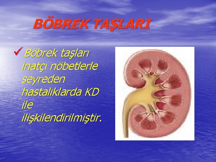 BÖBREK TAŞLARI üBöbrek taşları inatçı nöbetlerle seyreden hastalıklarda KD ile ilişkilendirilmiştir. 