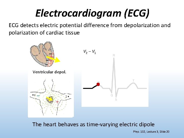 Electrocardiogram (ECG) ECG detects electric potential difference from depolarization and polarization of cardiac tissue