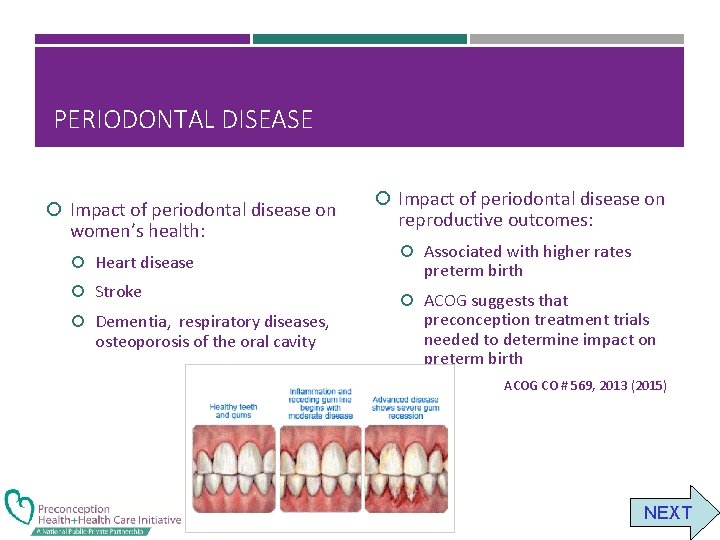 PERIODONTAL DISEASE Impact of periodontal disease on women’s health: Heart disease Stroke Dementia, respiratory