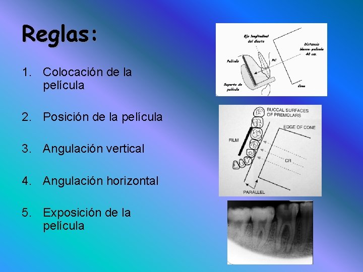 Reglas: 1. Colocación de la película 2. Posición de la película 3. Angulación vertical