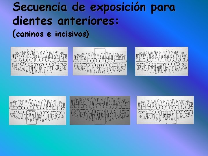 Secuencia de exposición para dientes anteriores: (caninos e incisivos) 