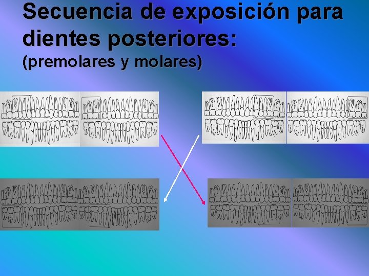 Secuencia de exposición para dientes posteriores: (premolares y molares) 