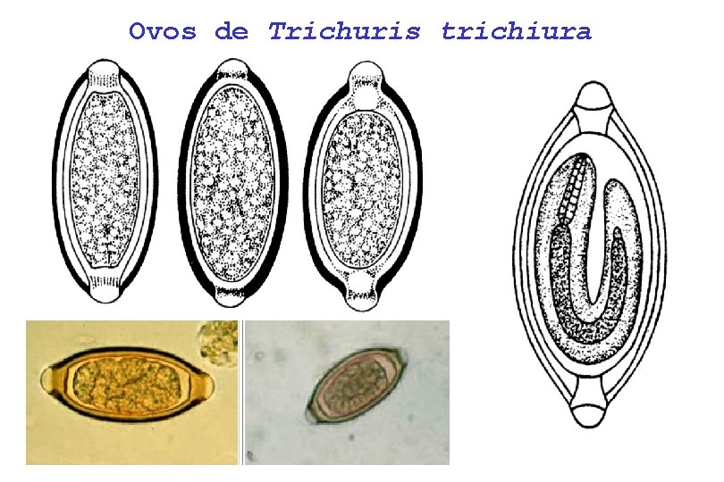 Ovos de Trichuris trichiura 