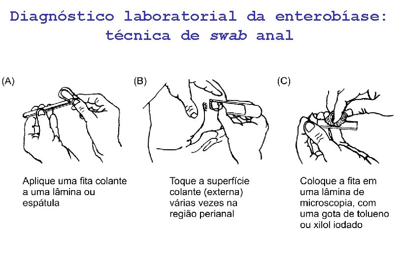 Diagnóstico laboratorial da enterobíase: técnica de swab anal 