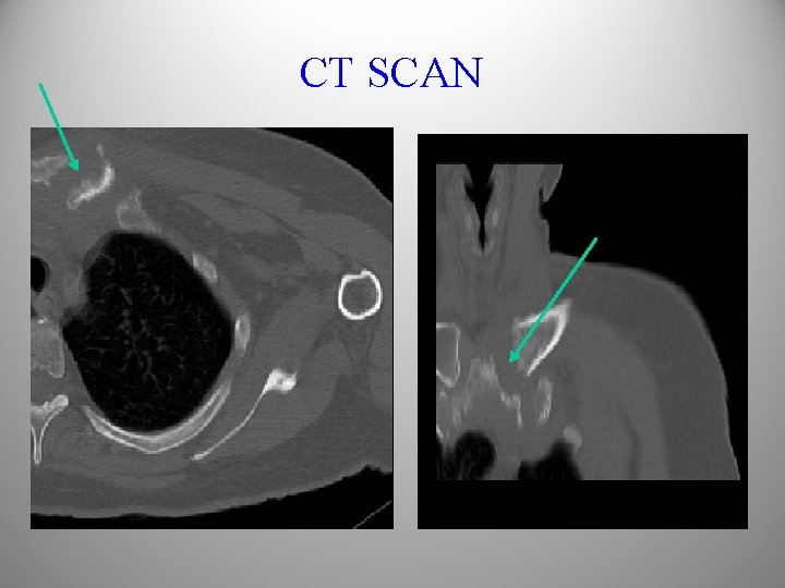 CT SCAN 