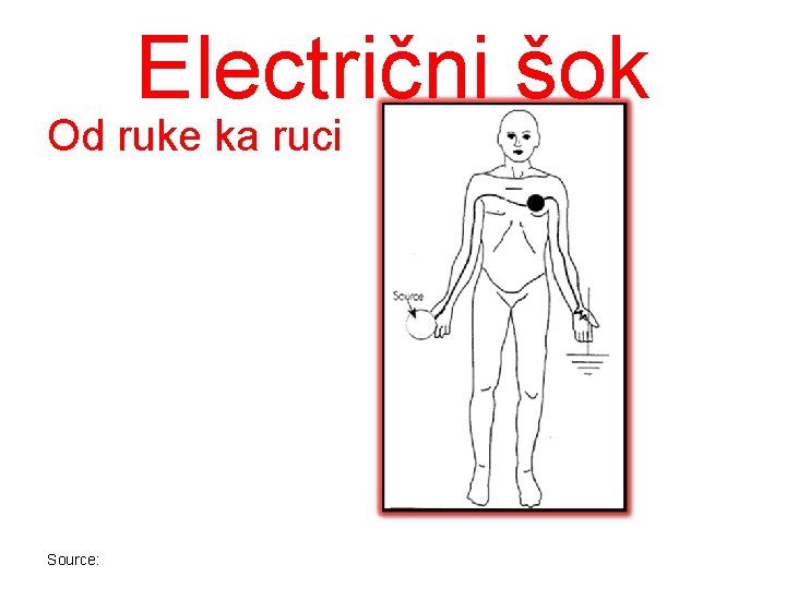Electrični šok Od ruke ka ruci Source: 