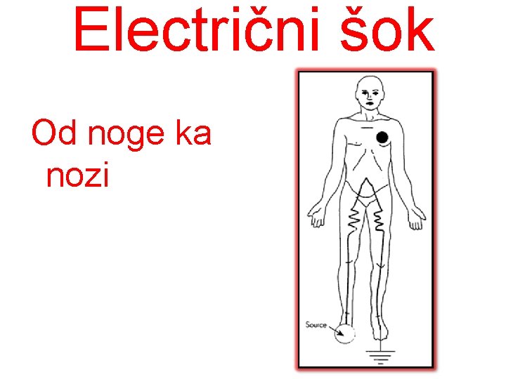 Electrični šok Od noge ka nozi 
