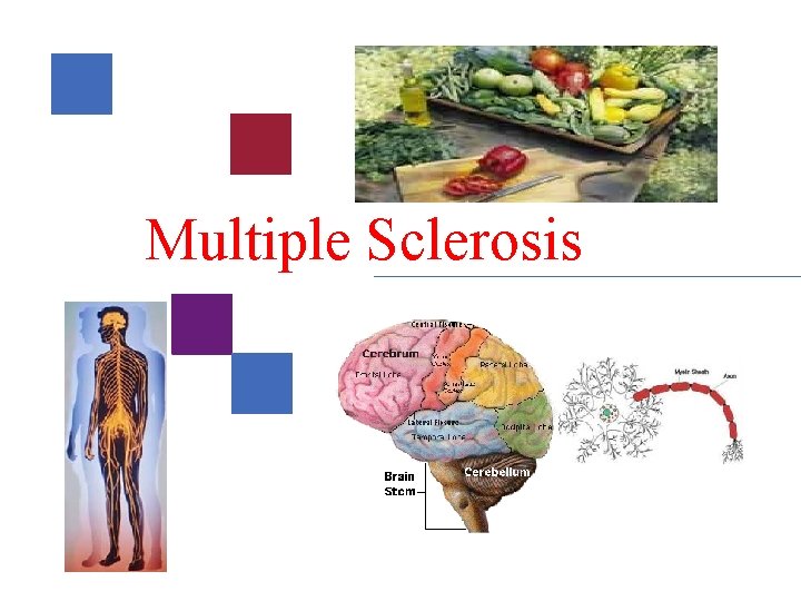 Multiple Sclerosis This presentation contains confidential and proprietary information of Caremark and cannot be