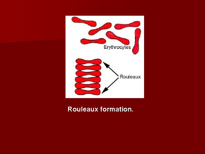 Rouleaux formation. 