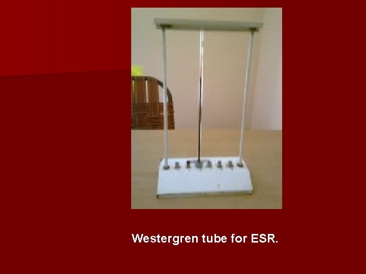 Westergren tube for ESR. 