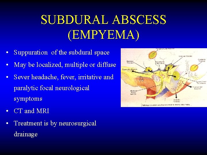 SUBDURAL ABSCESS (EMPYEMA) • Suppuration of the subdural space • May be localized, multiple