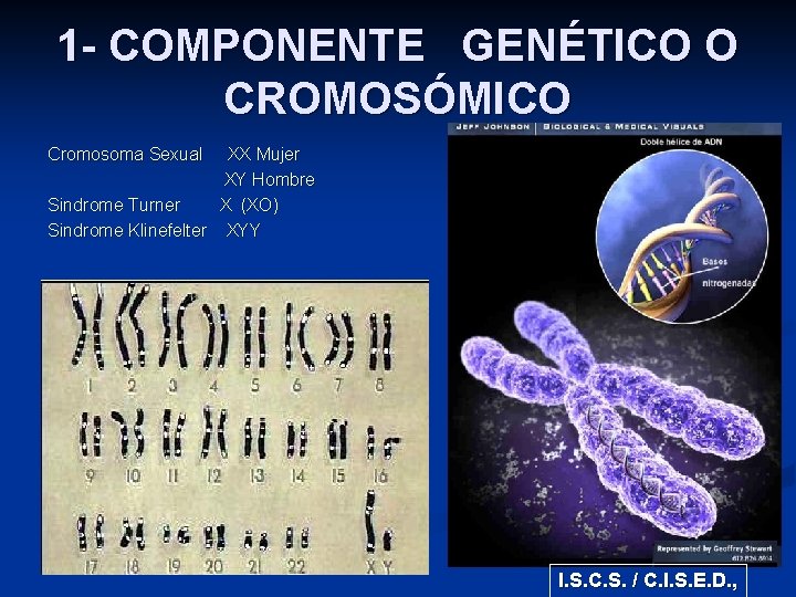 1 - COMPONENTE GENÉTICO O CROMOSÓMICO Cromosoma Sexual XX Mujer XY Hombre Sindrome Turner