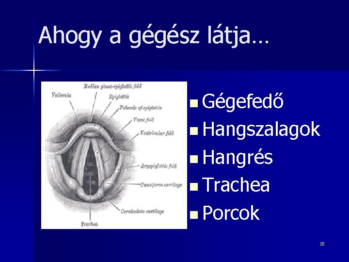 Ahogy a gégész látja… n Gégefedő n Hangszalagok n Hangrés n Trachea n Porcok