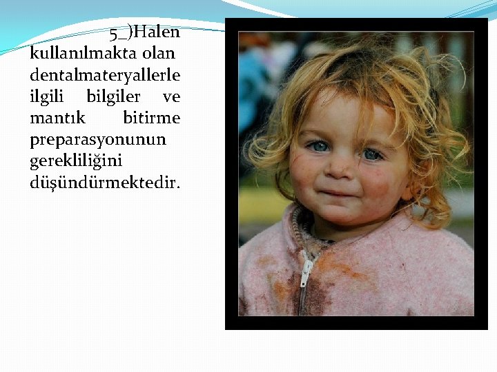 5_)Halen kullanılmakta olan dentalmateryallerle ilgili bilgiler ve mantık bitirme preparasyonunun gerekliliğini düşündürmektedir. 