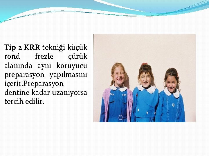 Tip 2 KRR tekniği küçük rond frezle çürük alanında aynı koruyucu preparasyon yapılmasını içerir.