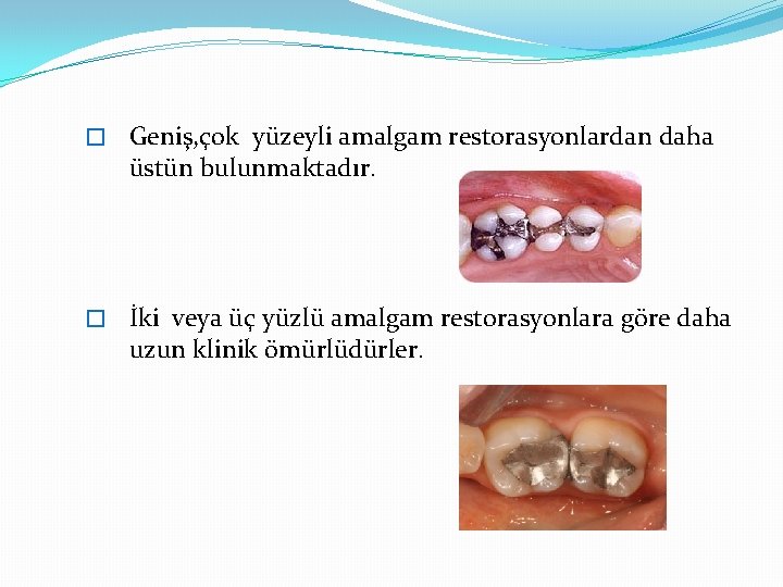 � Geniş, çok yüzeyli amalgam restorasyonlardan daha üstün bulunmaktadır. � İki veya üç yüzlü