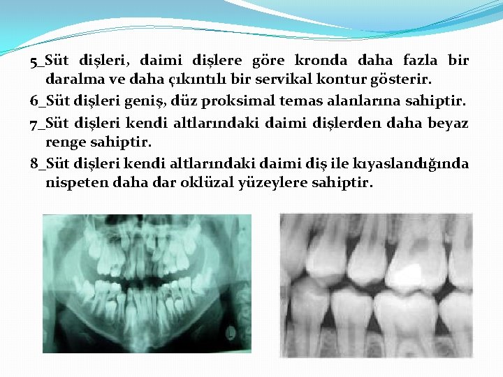 5_Süt dişleri, daimi dişlere göre kronda daha fazla bir daralma ve daha çıkıntılı bir