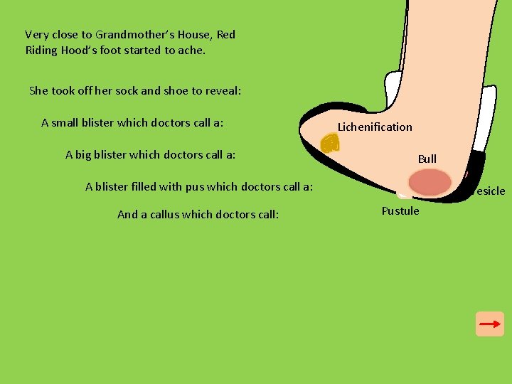 Very close to Grandmother’s House, Red Riding Hood’s foot started to ache. She took