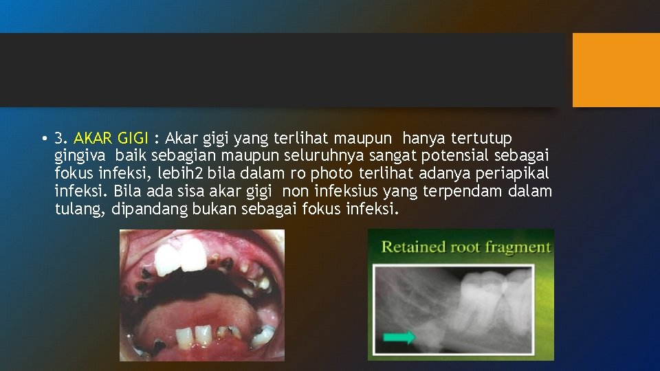 • 3. AKAR GIGI : Akar gigi yang terlihat maupun hanya tertutup gingiva • 3. AKAR GIGI : Akar gigi yang terlihat maupun hanya tertutup gingiva