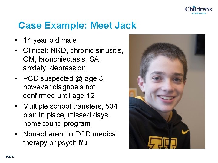 Case Example: Meet Jack • 14 year old male • Clinical: NRD, chronic sinusitis,