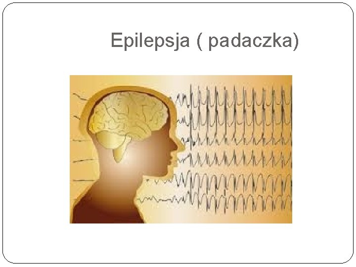 Epilepsja ( padaczka) 