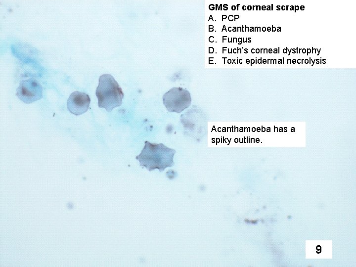 GMS of corneal scrape A. PCP B. Acanthamoeba C. Fungus D. Fuch’s corneal dystrophy