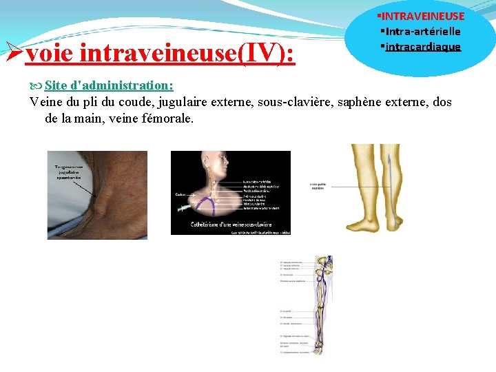Øvoie intraveineuse(IV): §INTRAVEINEUSE §Intra-artérielle §intracardiaque Site d'administration: Veine du pli du coude, jugulaire externe,