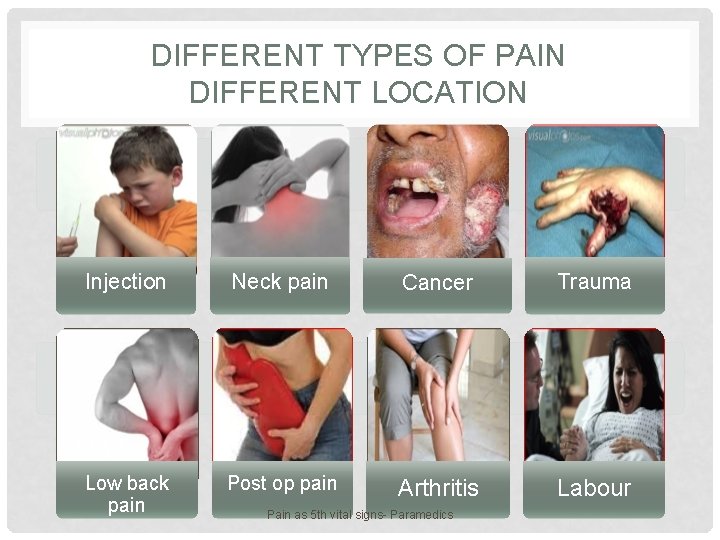 DIFFERENT TYPES OF PAIN DIFFERENT LOCATION Injection Neck pain Cancer Trauma Low back pain