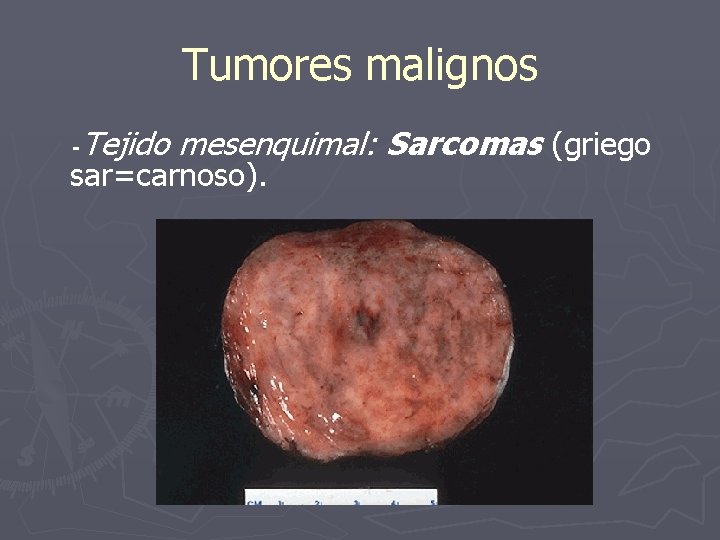 Tumores malignos Tejido mesenquimal: Sarcomas (griego - sar=carnoso). 