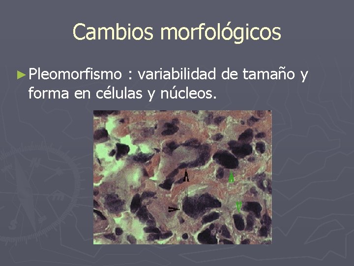 Cambios morfológicos ► Pleomorfismo : variabilidad de tamaño y forma en células y núcleos.