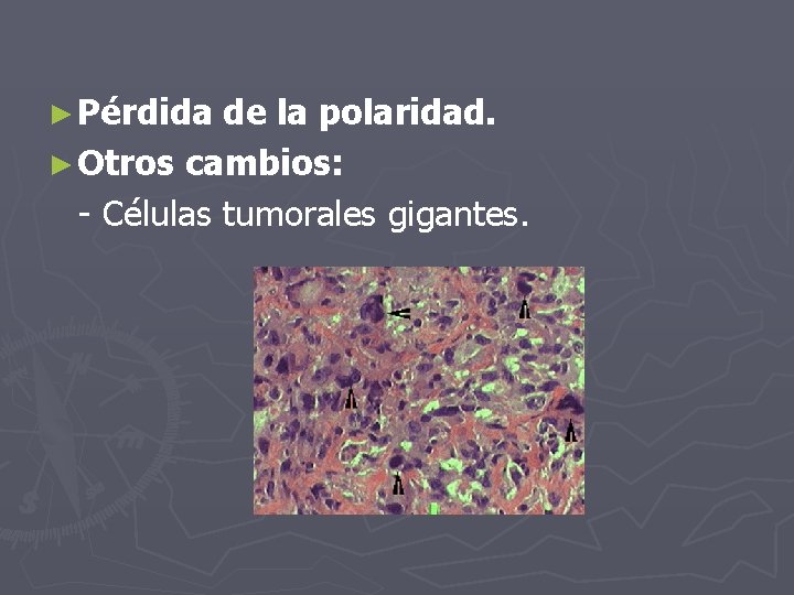 ► Pérdida de la polaridad. ► Otros cambios: - Células tumorales gigantes. 